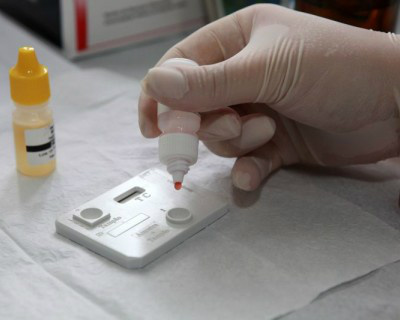 Programa DST/Aids realizará testes rápidos para HIV na próxima terça-feira