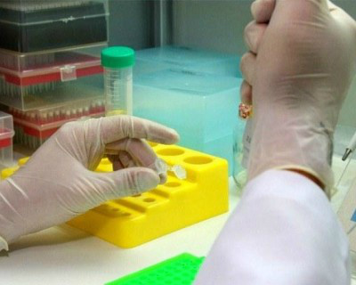 Planos de saúde passarão a cobrir testes para diagnóstico de zika em Três Lagoas