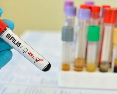Emprego de testes rápidos indicam grave aumento de sífilis no MS