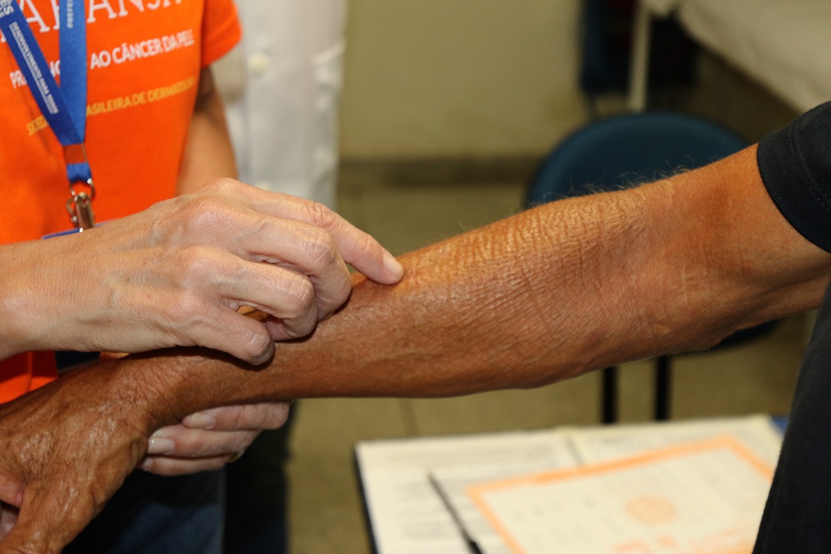 Com 20 casos confirmados, Secretaria Municipal de Saúde alerta para prevenção à Hanseníase Com 20 casos confirmados, Secretaria Municipal de Saúde alerta para prevenção à Hanseníase