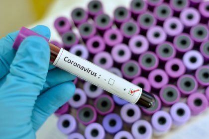 Saúde de Três Lagoas investiga o primeiro caso suspeito de reinfecção por Covid-19 no Município