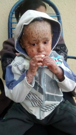Mãe de Portador de doença rara conta com ajuda para mantimentos Mãe de Portador de doença rara conta com ajuda para mantimentos