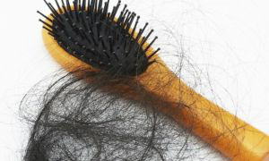 Conheça 5 causas da queda de cabelo e qual o melhor tratamento para cada uma delas Conheça 5 causas da queda de cabelo e qual o melhor tratamento para cada uma delas